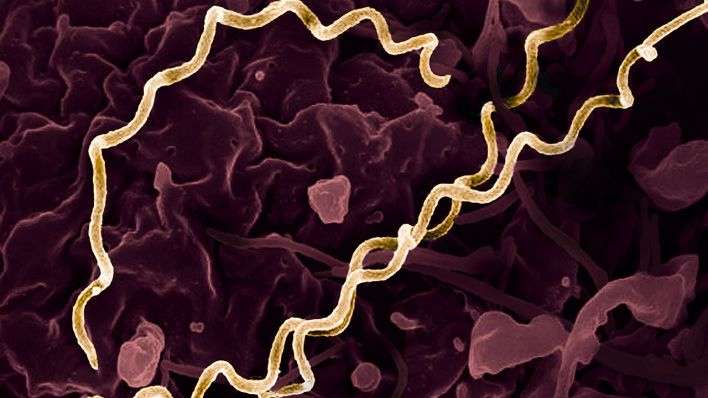 Kolorierte Elektronenmikroskopie von Treponema pallidum, den Bakterien, die Syphilis verursachen. Mehrere spiralförmige Bakterien wurden in Gold hervorgehoben © picture alliance / BSIP | NIH-NIAID / IMAGE POINT FR